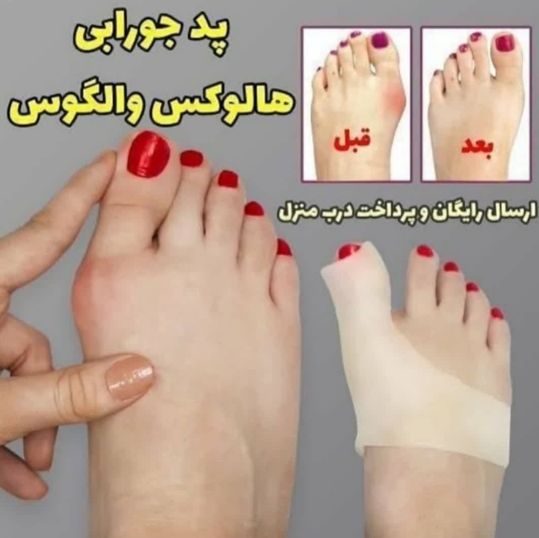 پدجورابی هالوکس والگو